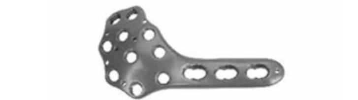 Дистальна медіальна мищелкова стегнова блокуюча пластина UMP